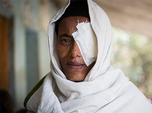 Eyelid Surgery for Trachoma 