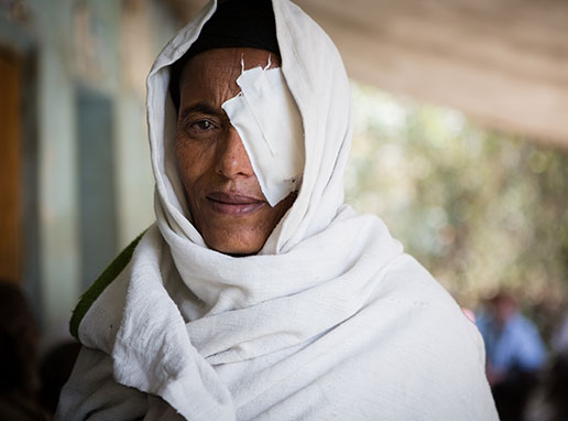 Eyelid Surgery for Trachoma 