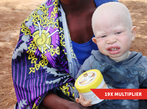 Sunscreen for a Child with Albinism